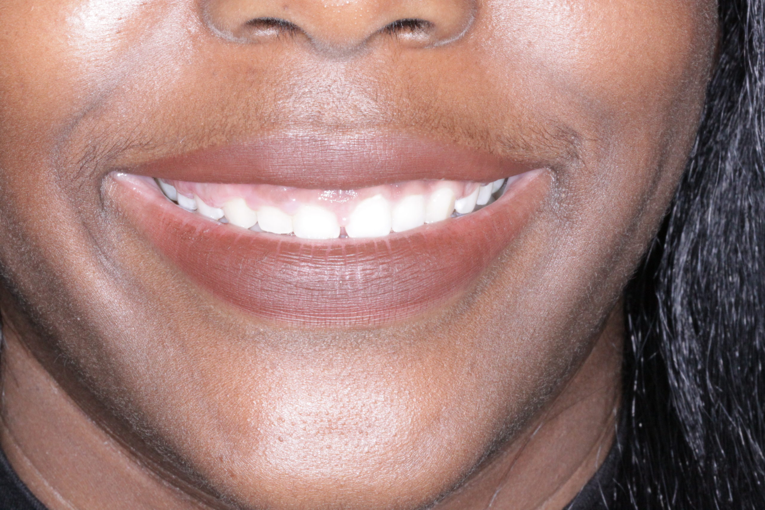 Mary - Scaled teeth