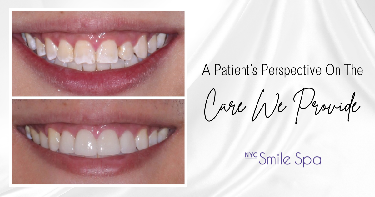 Before and after image