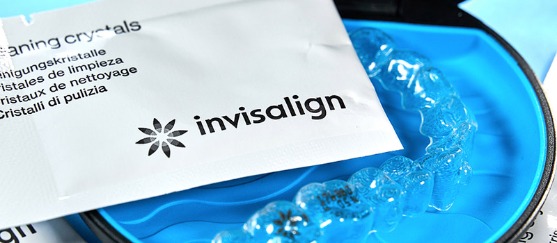 Invisalign example