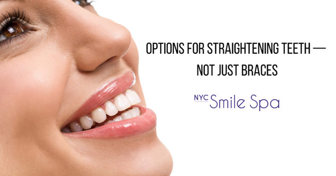 options for straightening teth