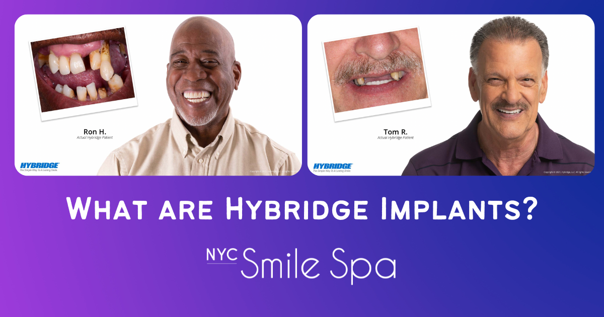 Krochak_Blog_July_1200x630 hybridge implants