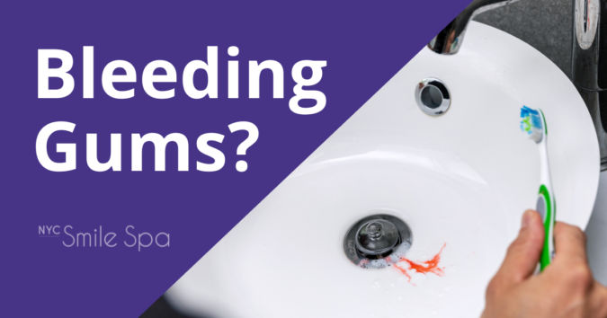 Krochak NYC Sept 23 Blog bleeding gums