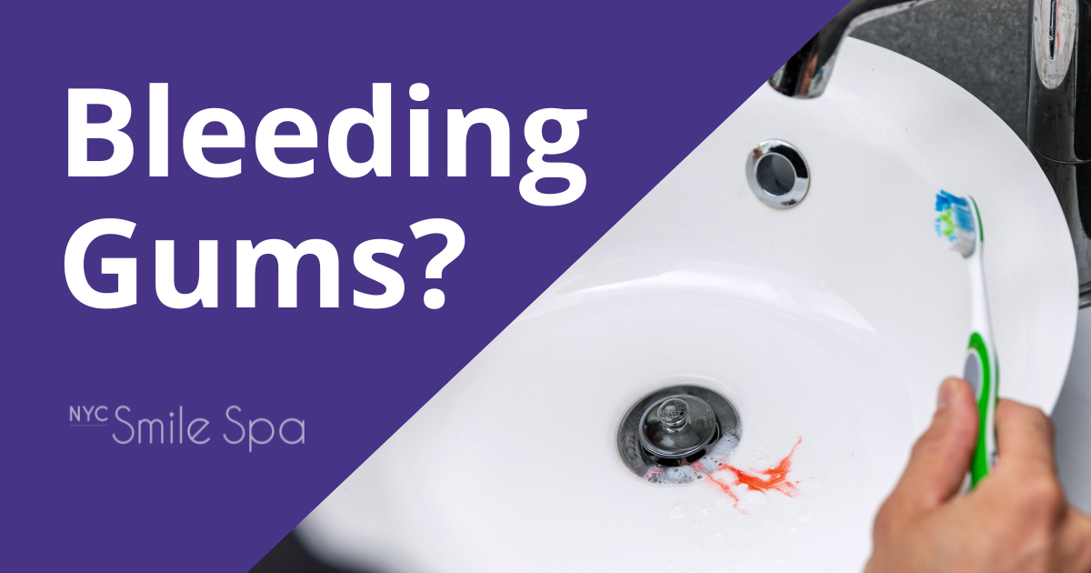 Krochak NYC Sept 23 Blog bleeding gums
