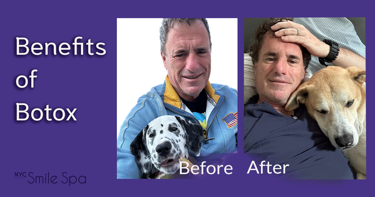 Krochak_Email-November-23 benefits of botox