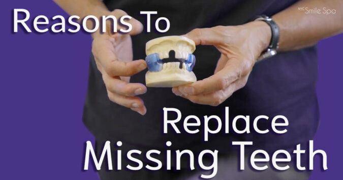 reasons to replace missing teeth