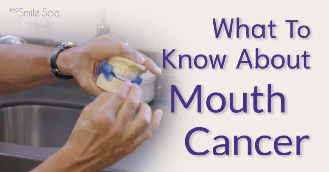 what to know about mouth cancer