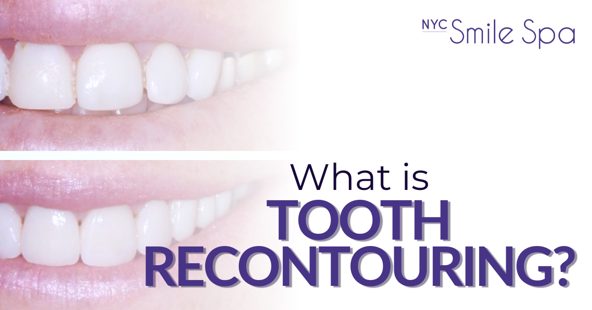what is tooth recontouring?