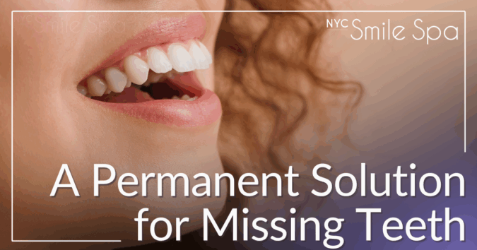 a permanent solution for missing teeth