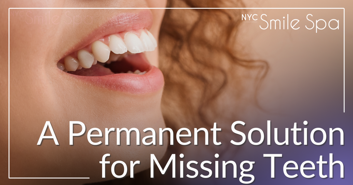 a permanent solution for missing teeth