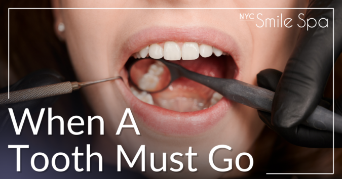 Krochak Email February 2026 when a tooth must go